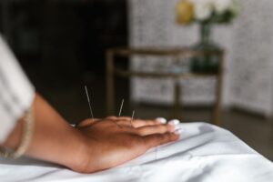 针灸的科学证据：哪些适应症有效？神经机制如何？