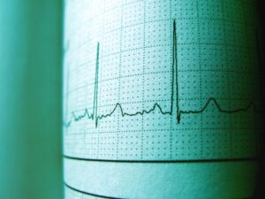 心率变异性（HRV）深度解析：自主神经调节与健康监测的科学基础